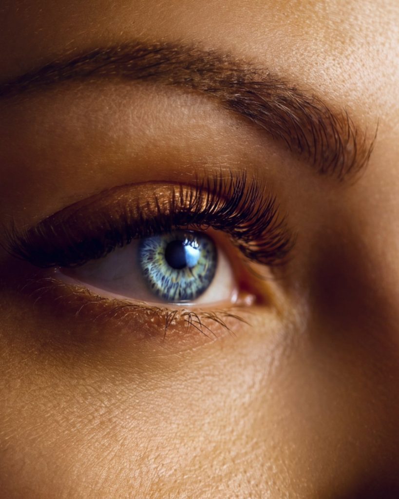 Lower eyelid surgery patient at Form MD Plastic Surgery