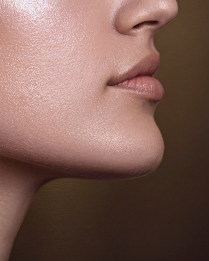 Neck lift patient at Form MD Plastic Surgery